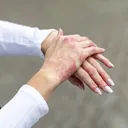 Eczema on the hands