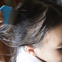 Head lice combing