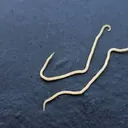 Threadworm